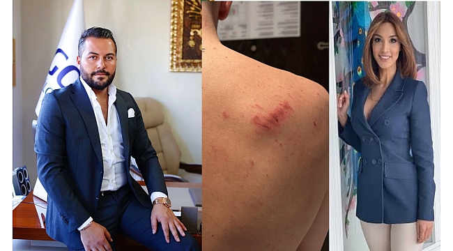 Cinsel Saldırı ve Tehdit: Bahis Çarkının Sırları!
